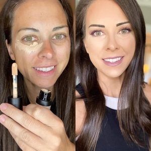 Skin solution concealer